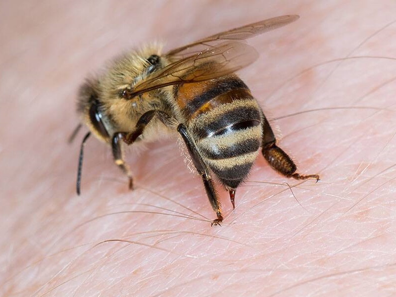10 parasta kotihoitoa mehiläisten pistoille