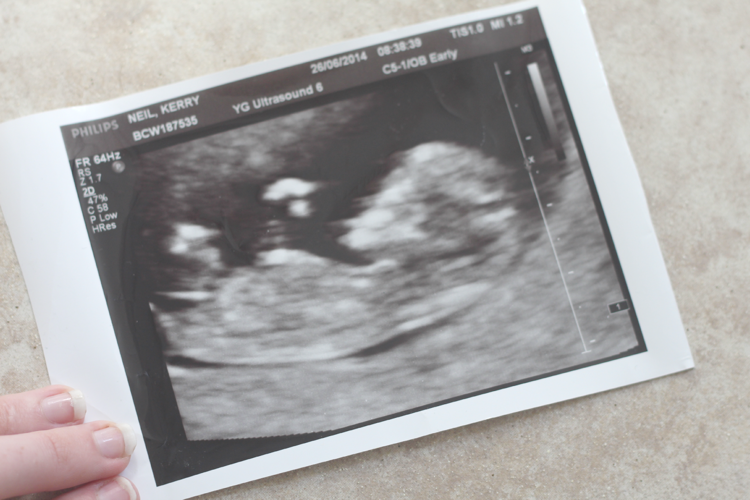 Meddela graviditet - idé ultraljudsbild