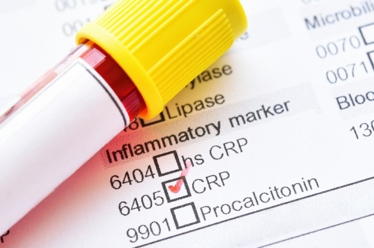 C-reaktivt protein ger information om immunsystemet är aktivt och om det finns en sjukdom