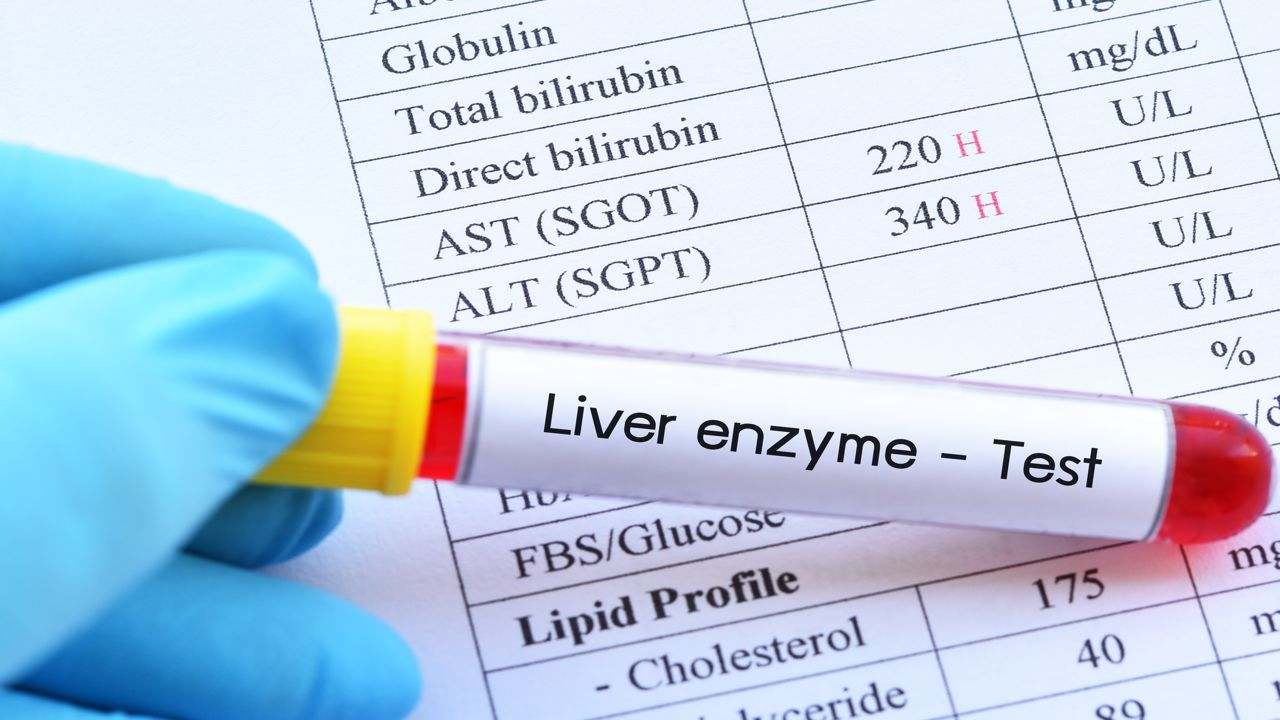 GPT -blodprov och leverenzymer visar om det finns leverskador från hepatit och andra sjukdomar