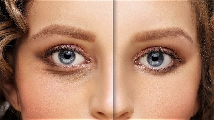 Övningar mot hängande ögonlock i ansiktsmusklerna tränar före och efter
