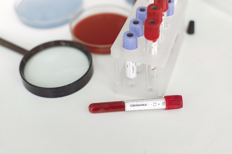 Undersök blodprov från smittade covid 19 i laboratoriet