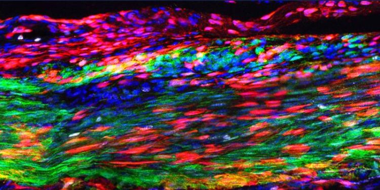 färgrik illustration laboratorieinspelning ärrvävnad stamceller sena
