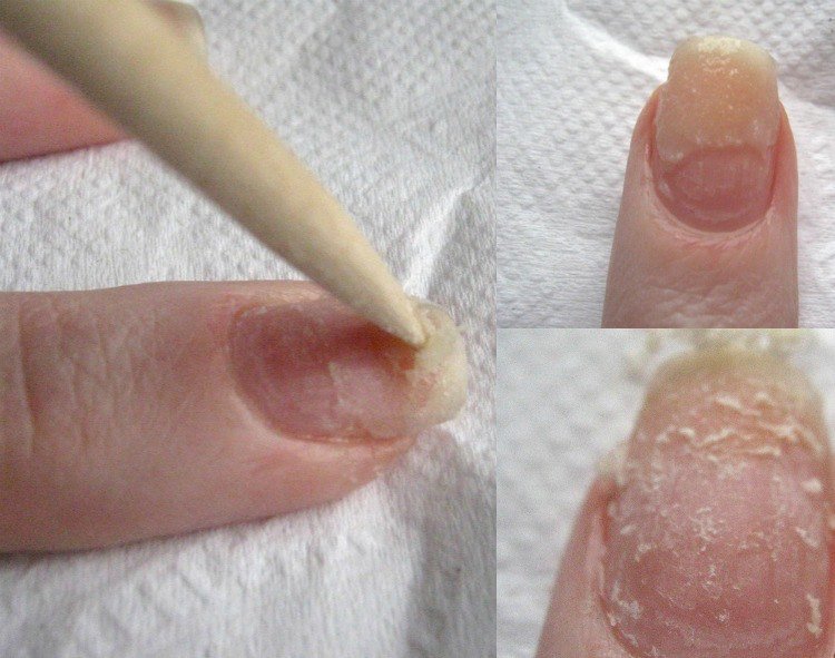 Hur man tar bort gel-naglar-instruktioner-huskurer-själv-fil-tips