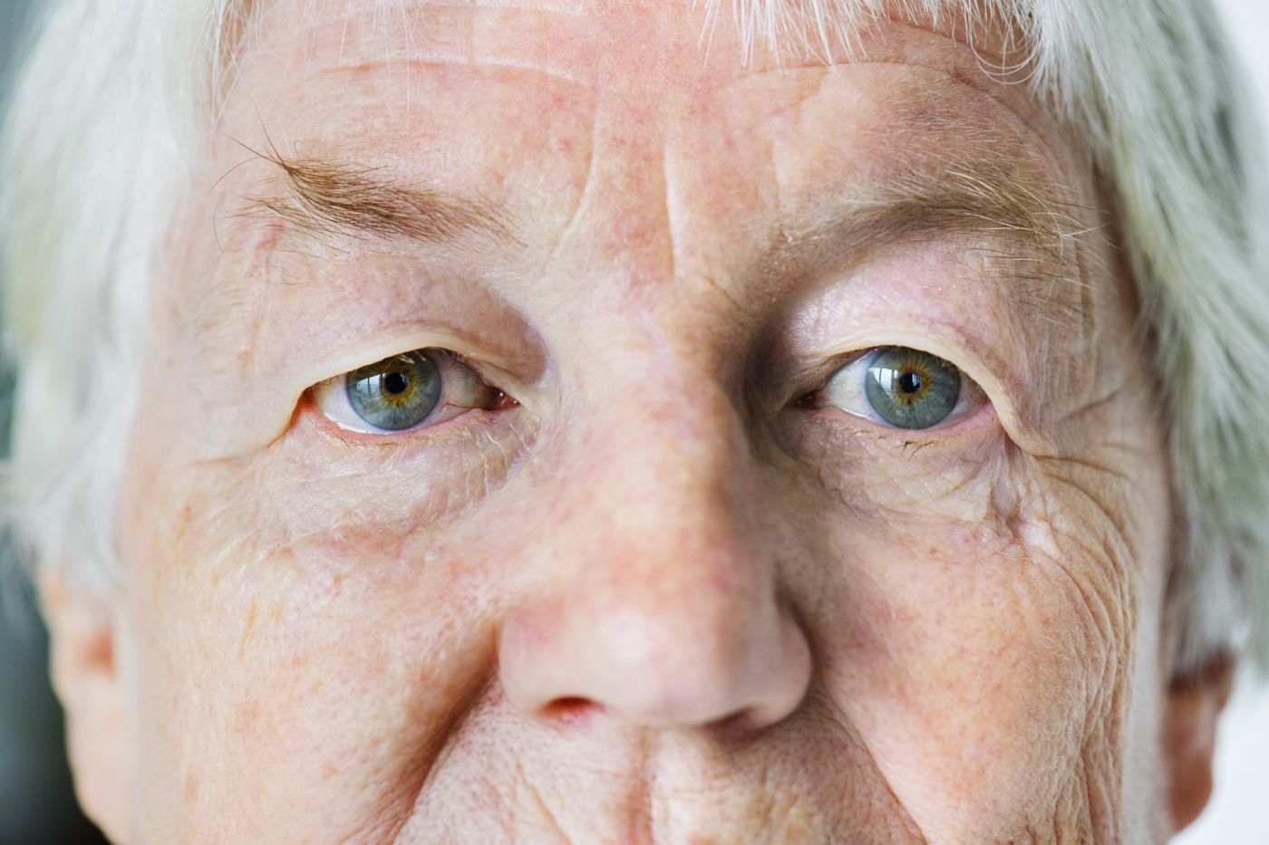 Vad är katarakt symptom på ögonsjukdom