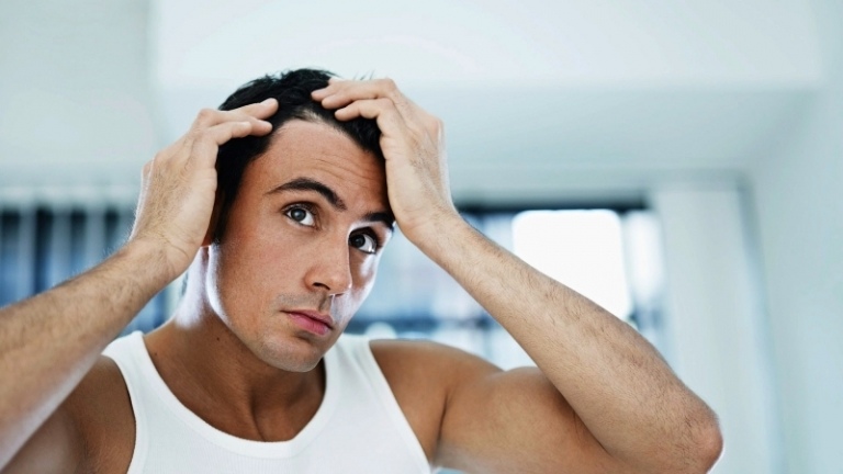 Stoppa håravfall Män Idéer Tips