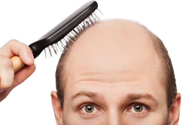 Hårmask-gör-det-själv-orsakar-håravfall