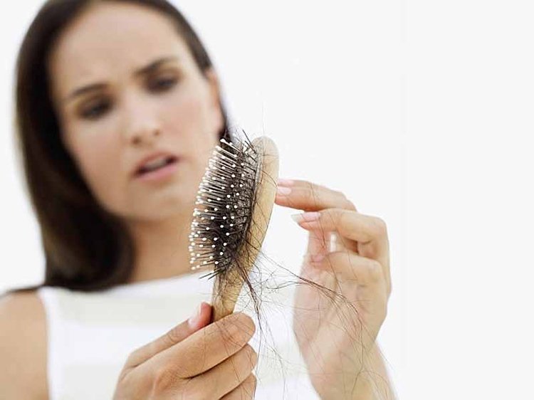 Hårtransplantation-håravfall-håravfall-kvinnor