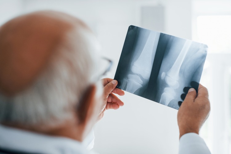 Äldre läkare håller röntgen av ben