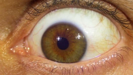 Eye Ball Rotate