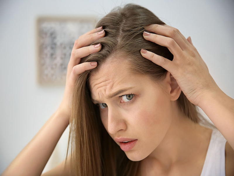Πώς να θεραπεύσετε τη φαλάκρα μαλλιών στο σπίτι