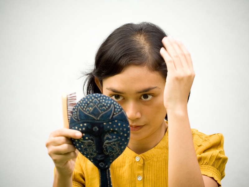 Πώς να αντιμετωπίσετε τη μερική φαλάκρα μαλλιών