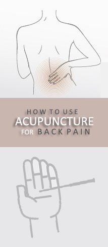 akupunktio selkäkipuun