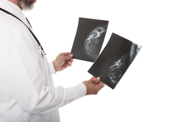 Läkare undersöker röntgenbilder av patient med bröstcancer