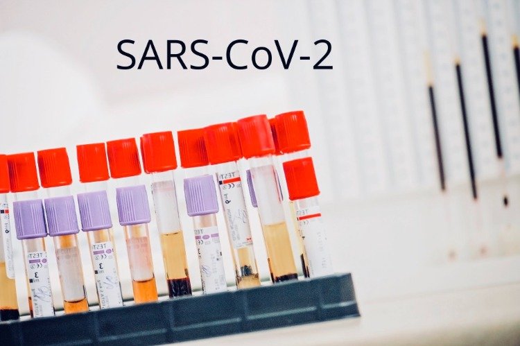 analysera blodprov från sars cov 2 -antikroppar under pandemin