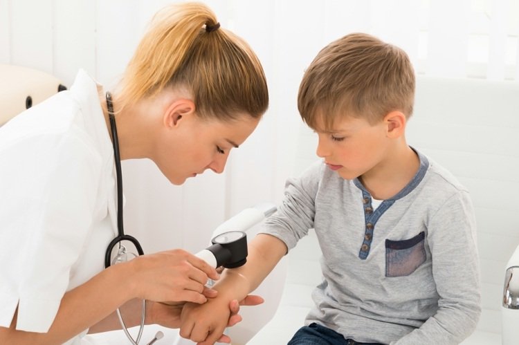 Myggbett behandlar vuxna och barn med läkare för allergier och inflammation
