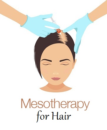 mesoterapia hiuksille