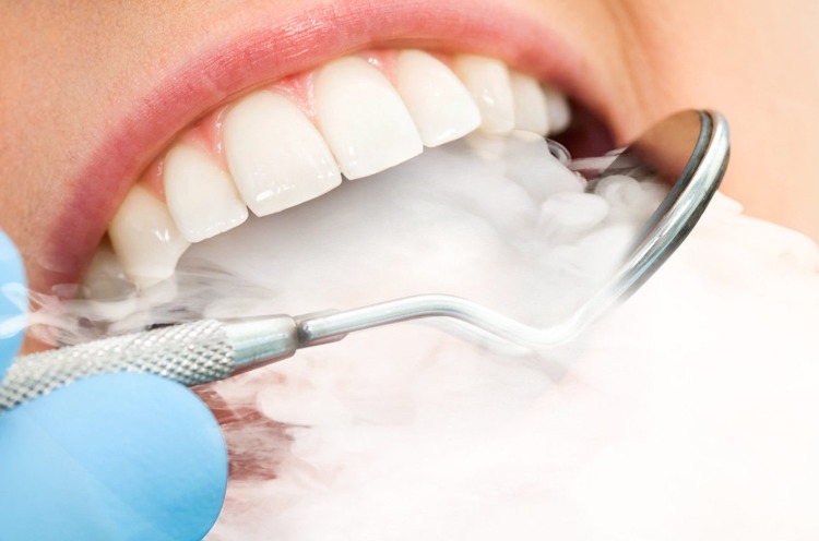cigarettrök kommer från patientens mun hos tandläkaren