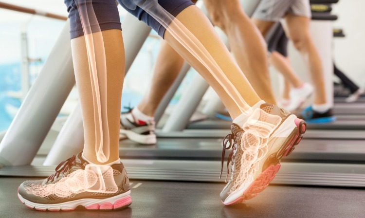 Ben med ben visas som röntgen på löpbandsträning i gymmet