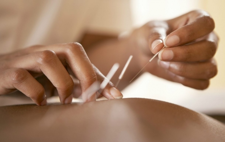 Åtgärder för tips om hösnuva -akupunktur