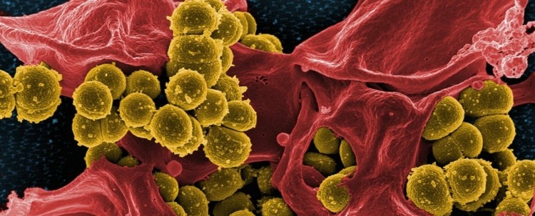 Behandla multiresistenta bakterier och bakterier med nya antibiotika