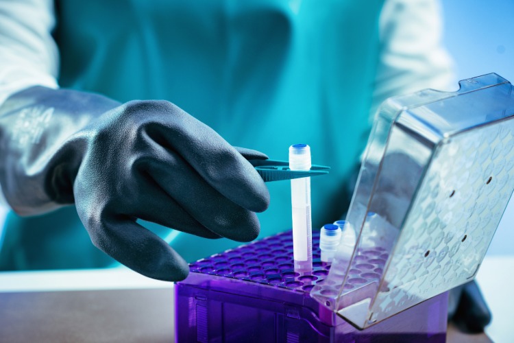 biobank och låga temperaturer för beredning av biologiska prover