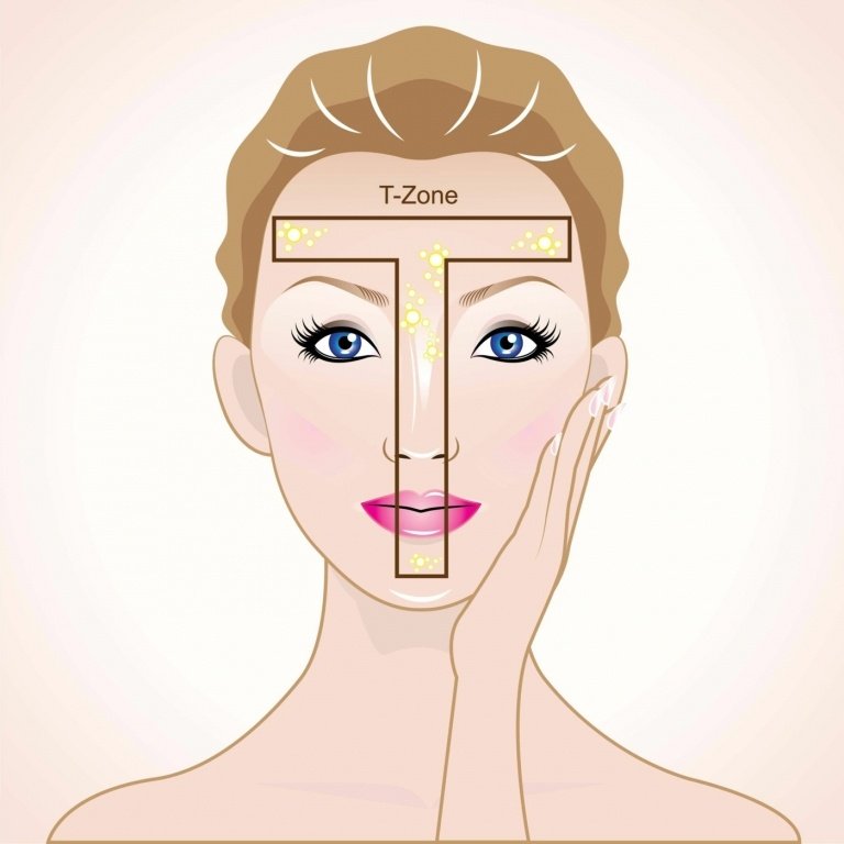T-zonen är området runt näsan och pannan och plågas ofta av finnar under huden