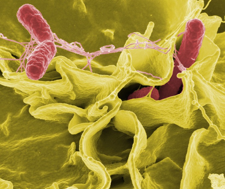 farliga bakterier orsakar salmonellasymtom vid dålig hygien