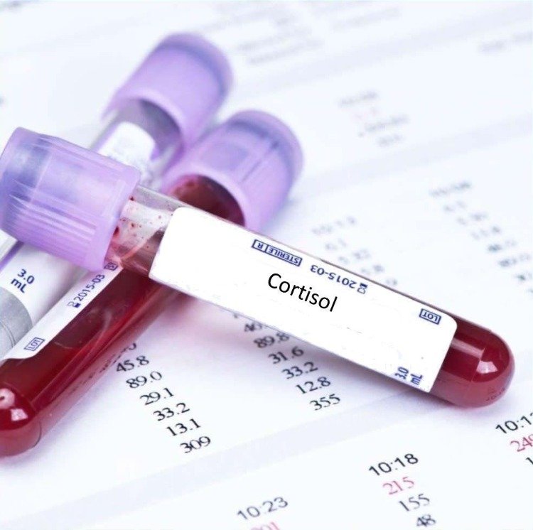 blodprov i laboratoriet för testning av kortisol