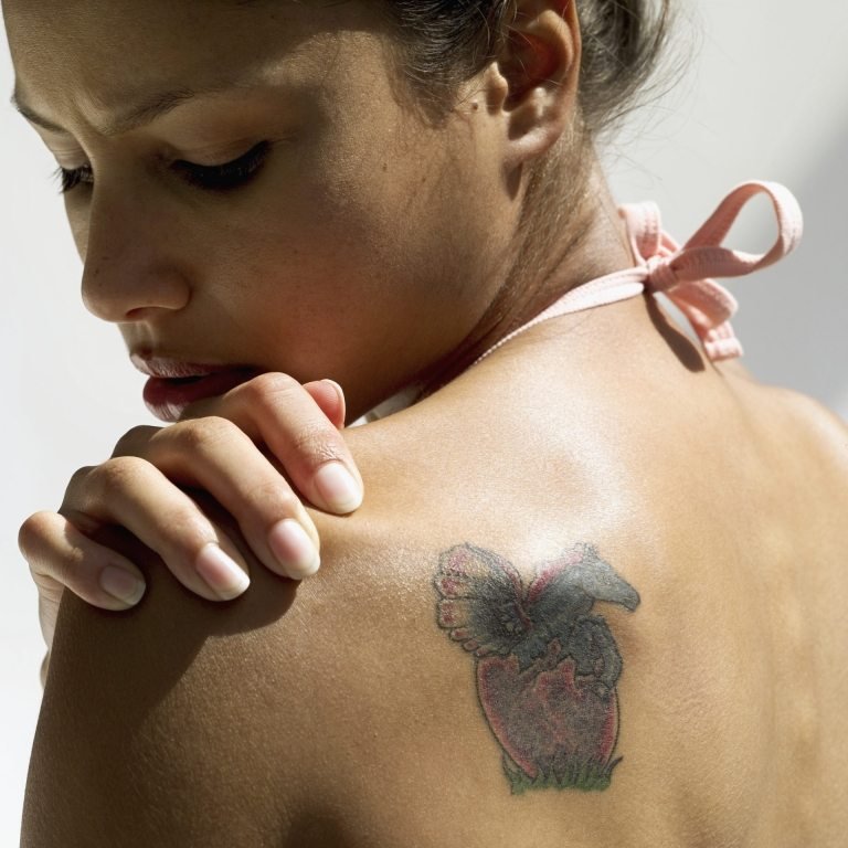 Tatueringsborttagning laser kostar metoder för borttagning av tatueringar