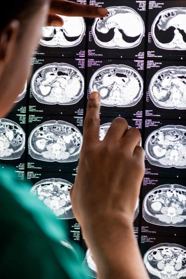 läkare undersökte röntgen djup hjärnstimulering depression tvångssyndrom forskning