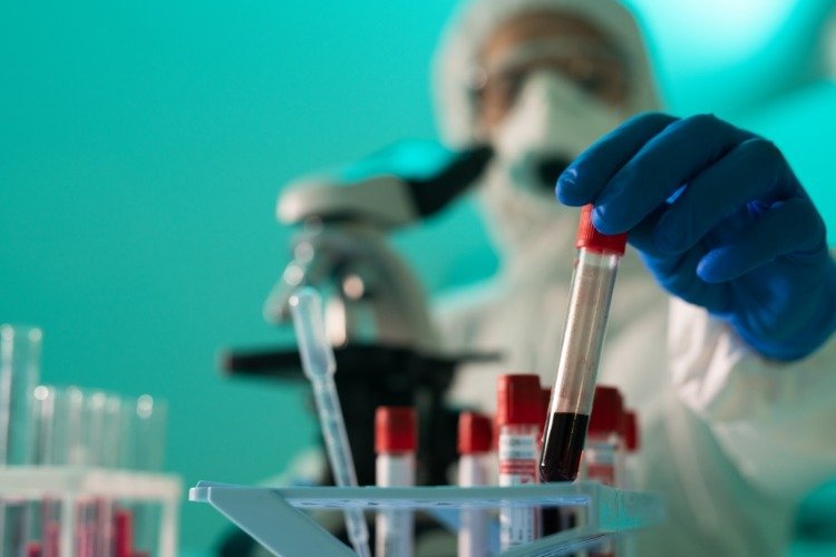 Forskare kontrollerar blodprov för blodproppar vid en covid 19 -infektion i laboratoriet