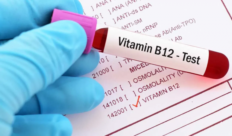 Vitamin B12 tabletter blodprov vitamin B12 brist symptom
