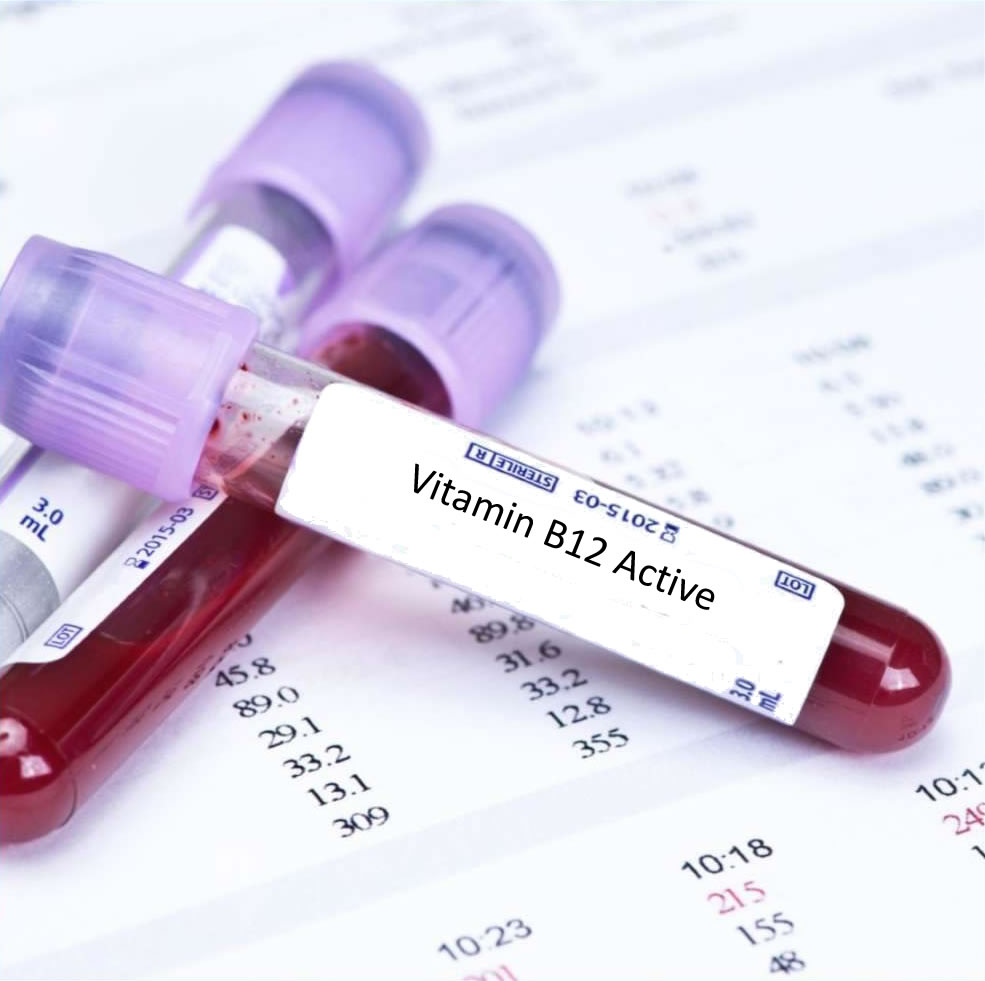 Vitamin B12 undersökning blodprov stora blodtal kostar husläkare