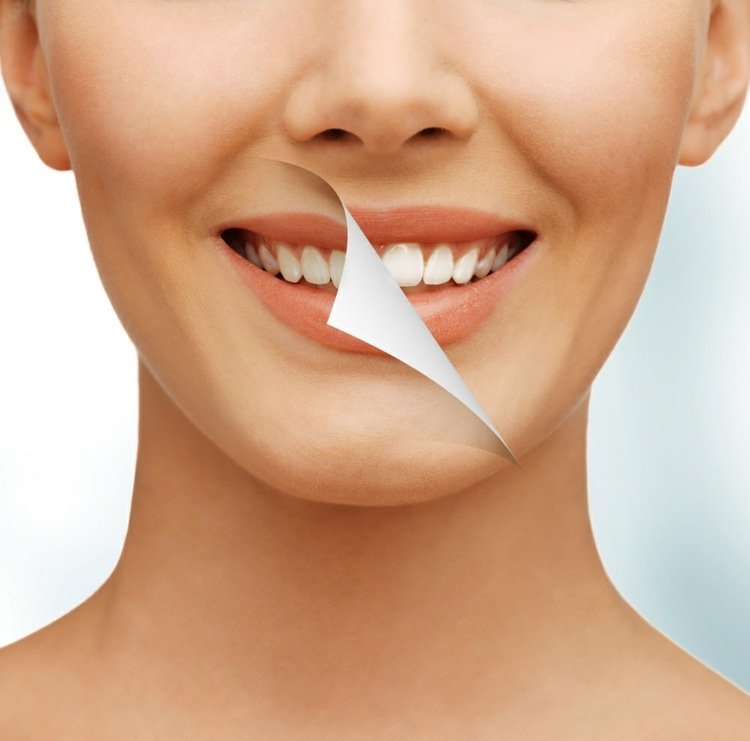 vita tänder får missfärgade-förebyggande-tips-friska-tänder