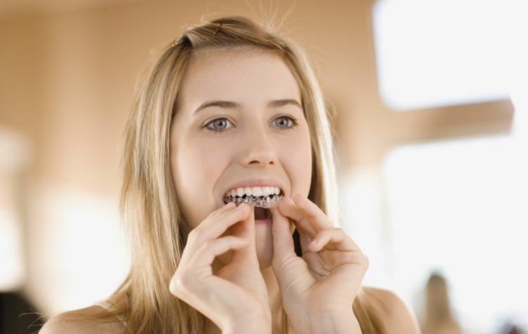 vita tänder-få-skena-gel-vitare-idé-tandtekniker-tips
