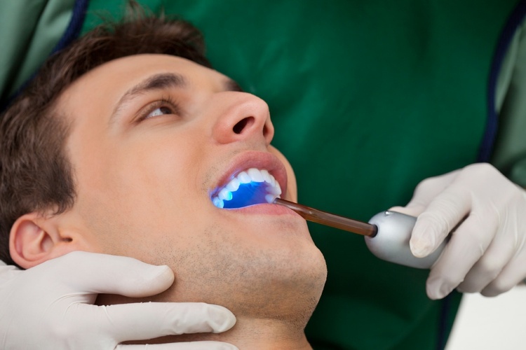man tandblekning behandling tandläkare