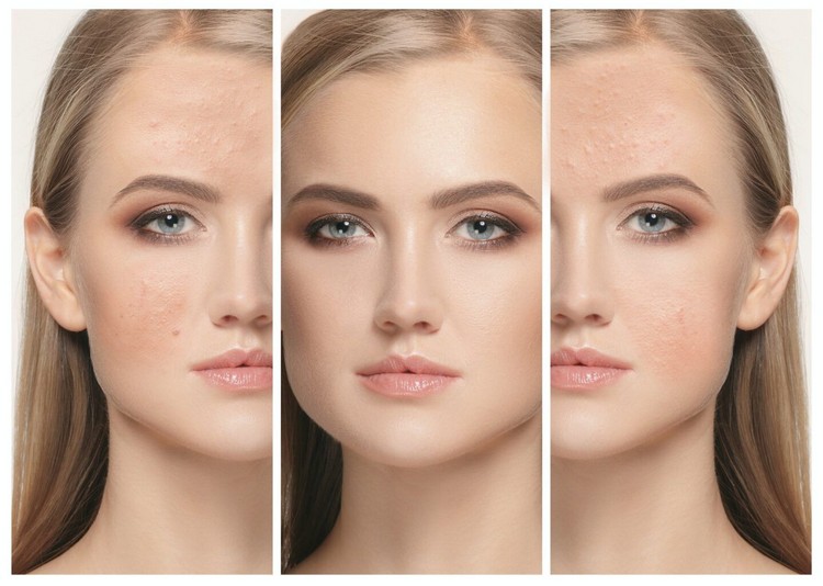 vilken primer för stora porer problematiska hudsmink tips