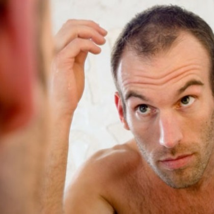 Miten DHT aiheuttaa hiustenlähtöä