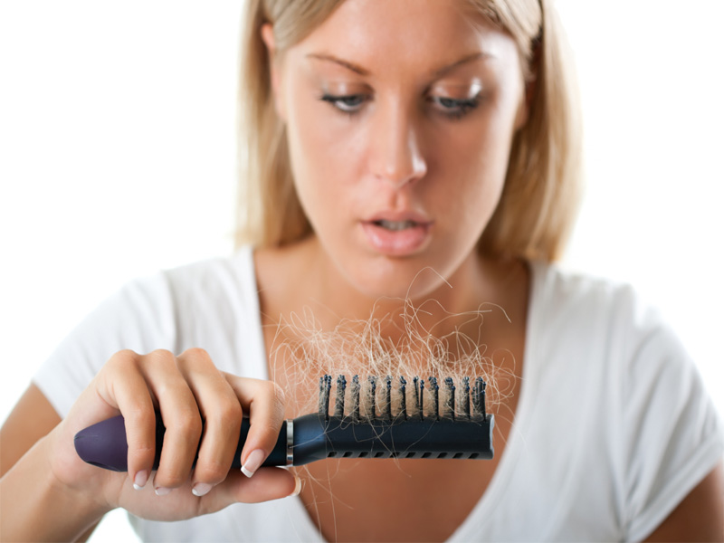 Mikä aiheuttaa Dht -hiustenlähtöä ja miten sitä hoidetaan