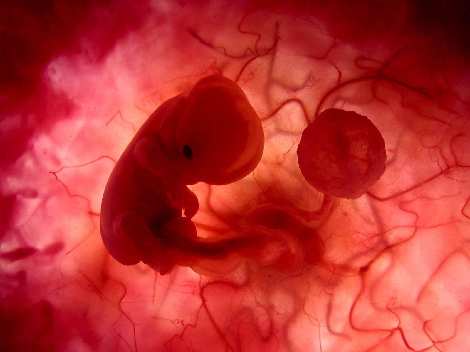 Fosterets utveckling - embryot i livmodern med navelsträngen och moderkakan