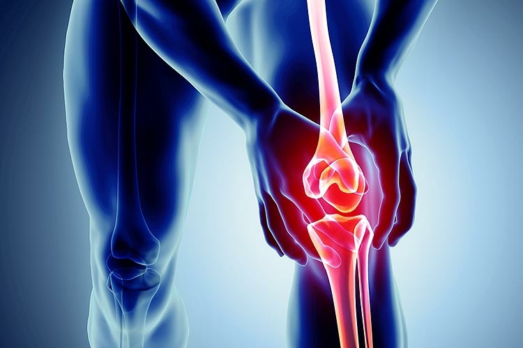 Behandla knän och annan smärta i lederna med ostmassa