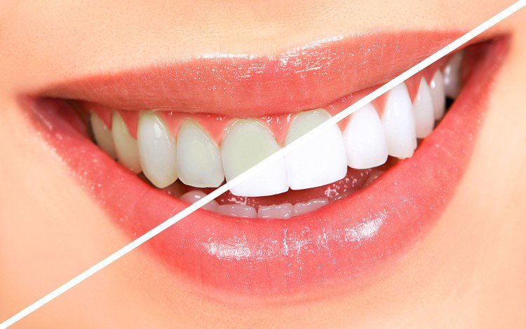 gör tandkräm själv huskurer recept tips tips idéer blekning ljusare leende naturligt